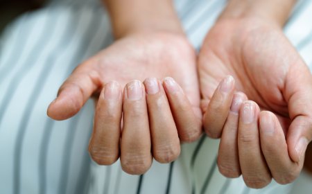 How to Prevent Dry & Brittle Nails in Canada’s Harsh Winter