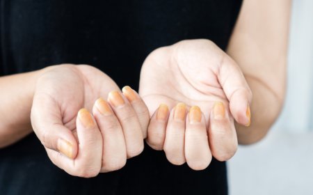 Prevent Nail Damage During Canada’s Harsh Winters – Expert Tips