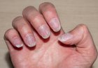 Nail Care in Humid Weather: Tips to Prevent Lifting & Cracking