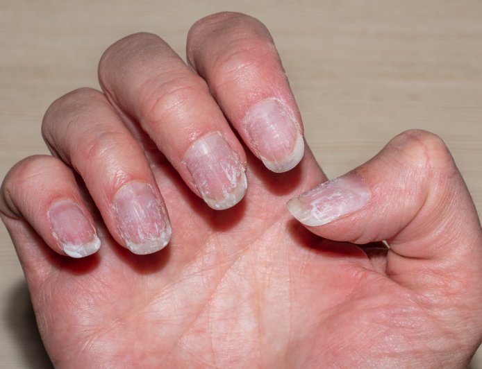 Nail Care in Humid Weather: Tips to Prevent Lifting & Cracking