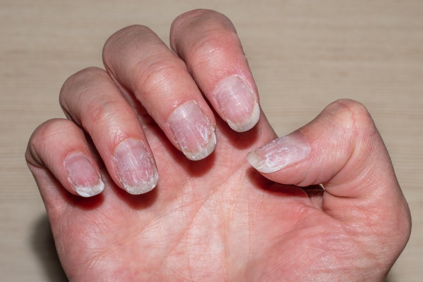 Nail Care in Humid Weather: Tips to Prevent Lifting & Cracking